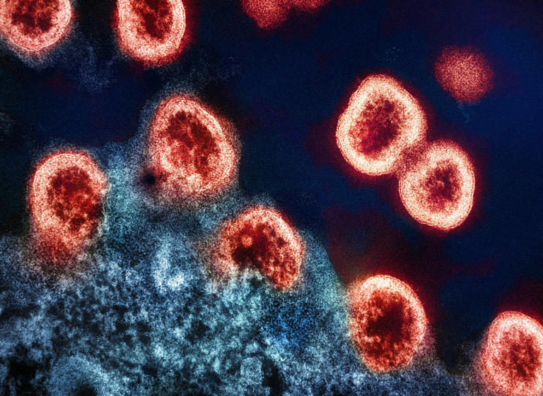 Russian lab accident triggers plague scare and quarantines after ...