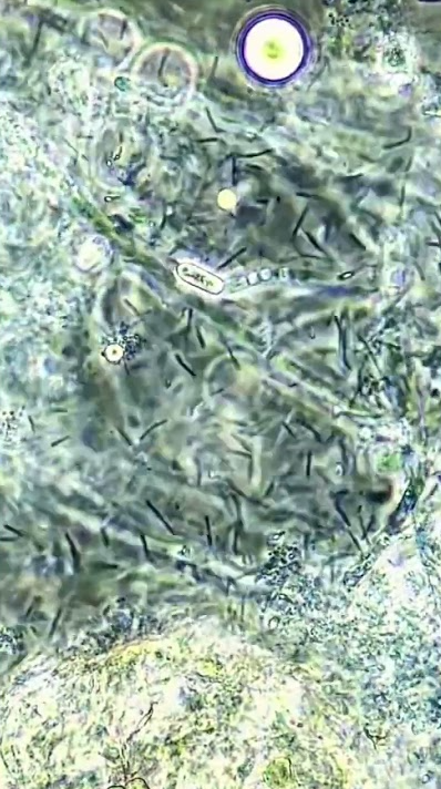 Bacteria vs hydrogen peroxide under the microscope
