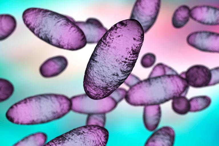 Fears Russian plague outbreak started in biological weapons lab as new ...