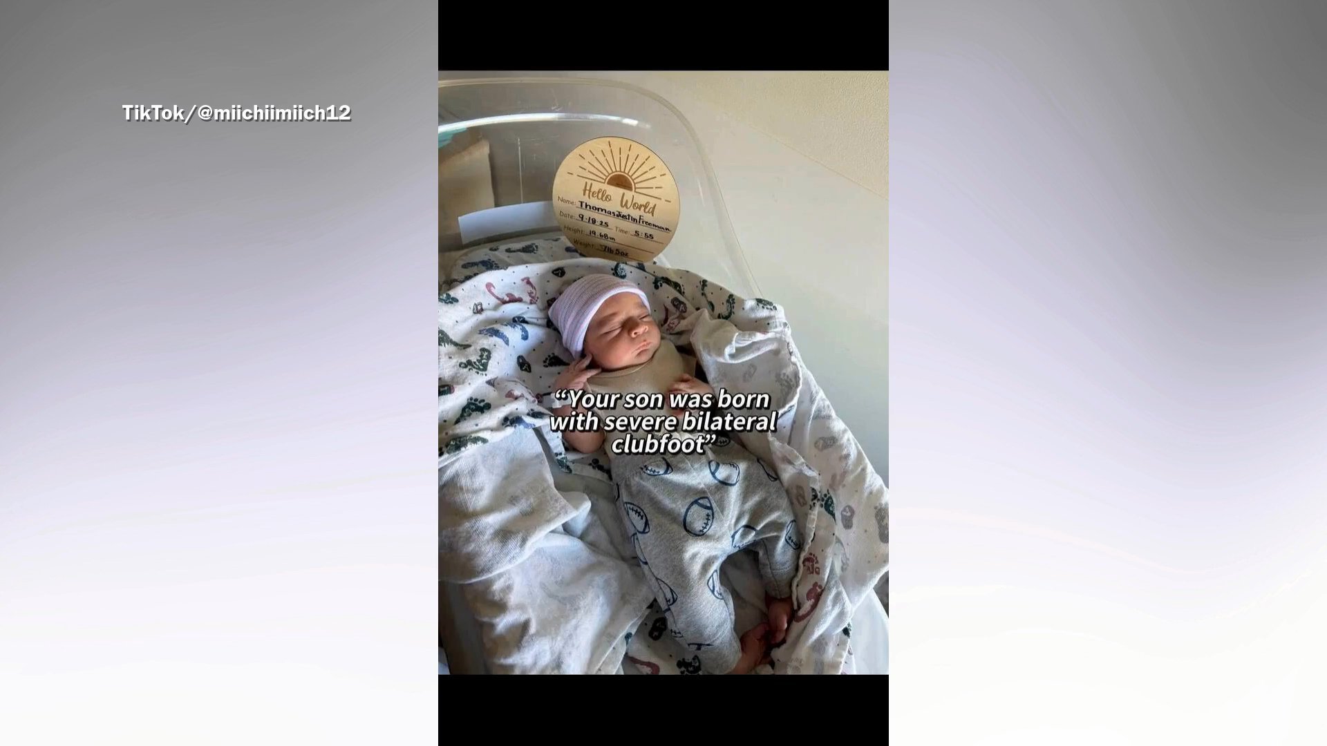 Woman told baby boy needs X-ray, then comes shock three-word diagnosis
