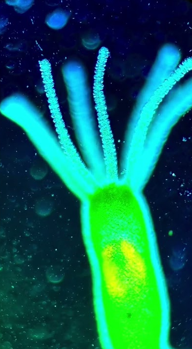 What a hydra looks like under the microscope