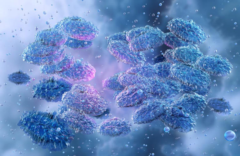 Employee of Russian plague institute dies of suspected pneumonic ...