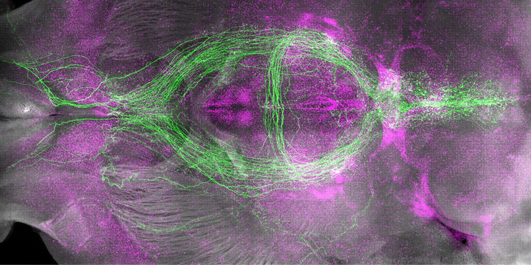 Why do we get sleepy? New study reveals brain cells that help drive sleep