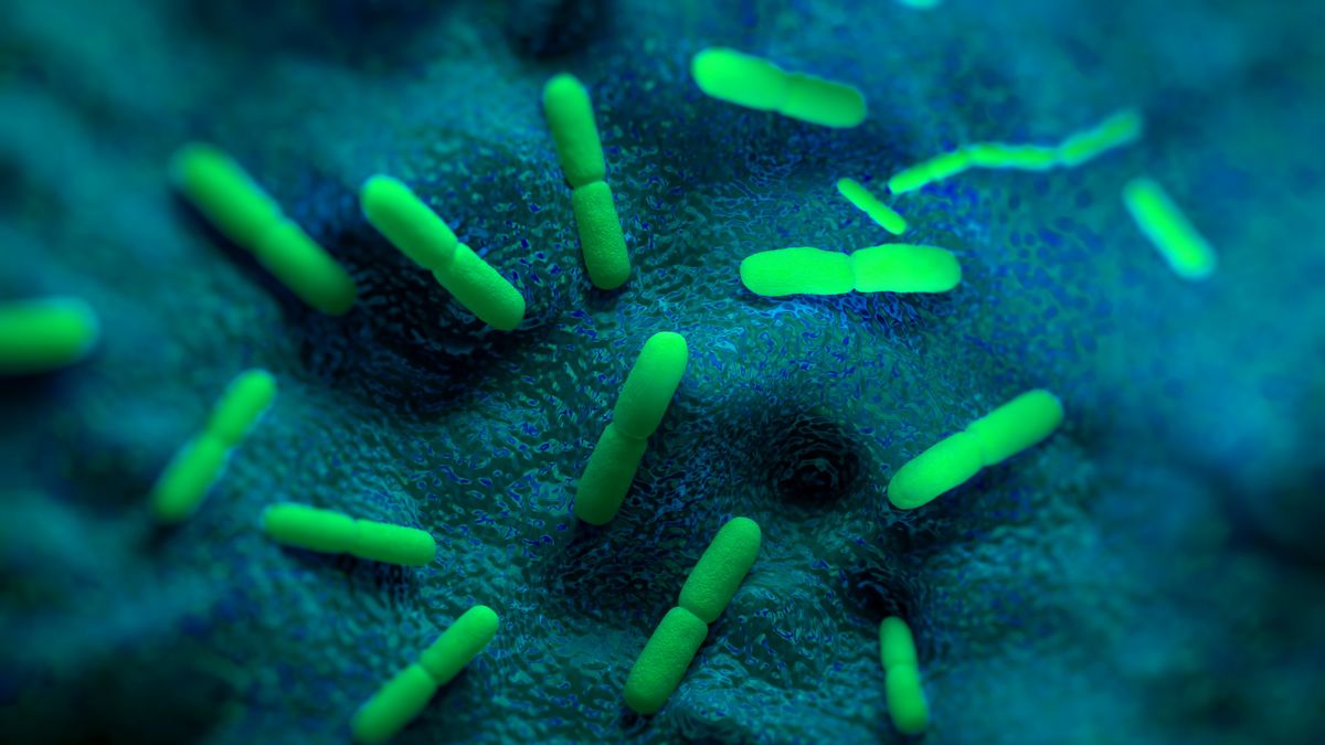Russian lab worker reportedly died of pneumonic plague. Here's what we know
