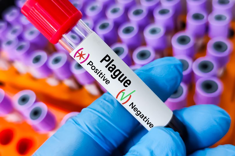 'Plague' reported to have killed Russian lab worker, rarest but most severe