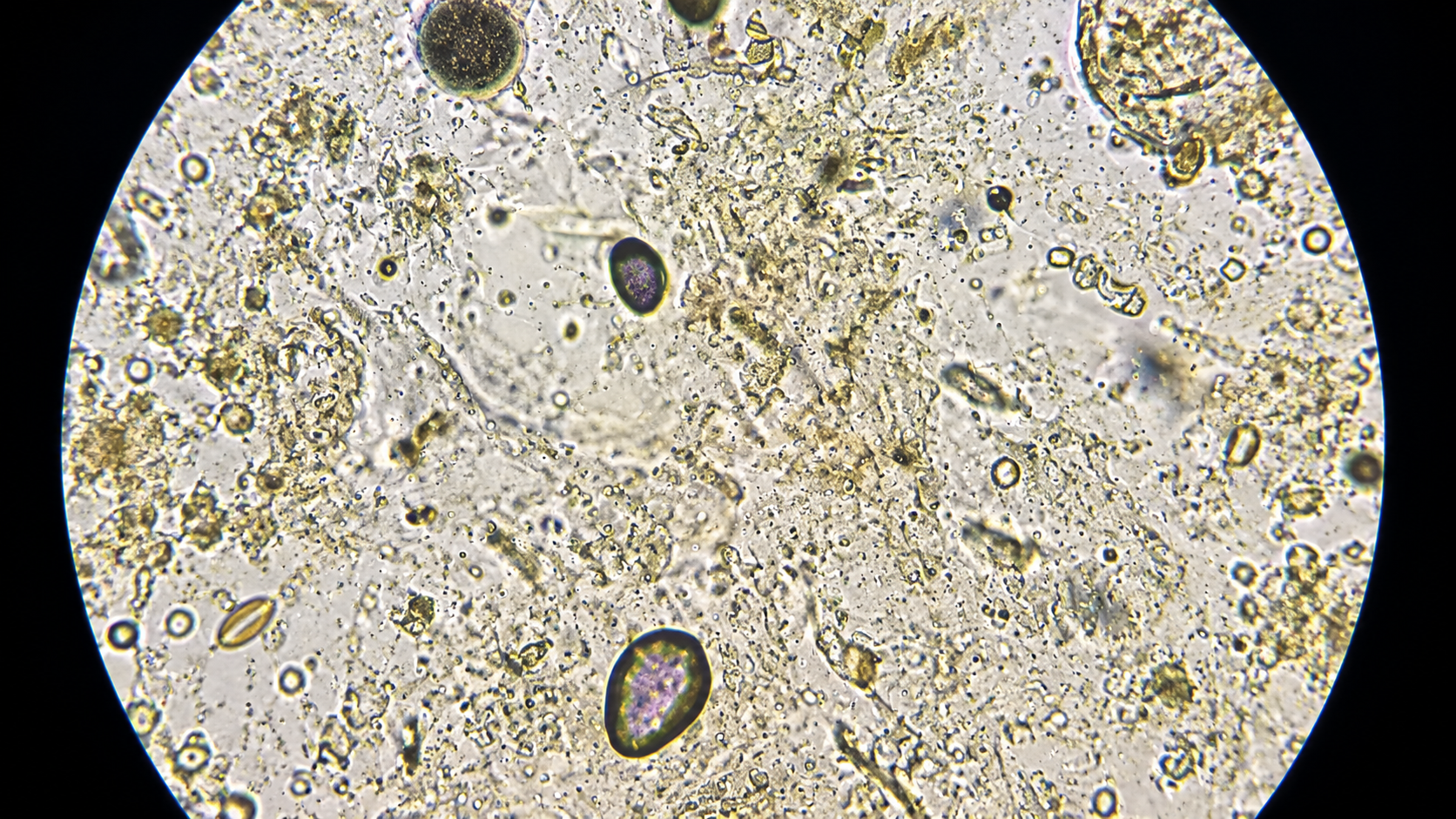 Hidden microscopic evidence reveals unexpected life in everyday things