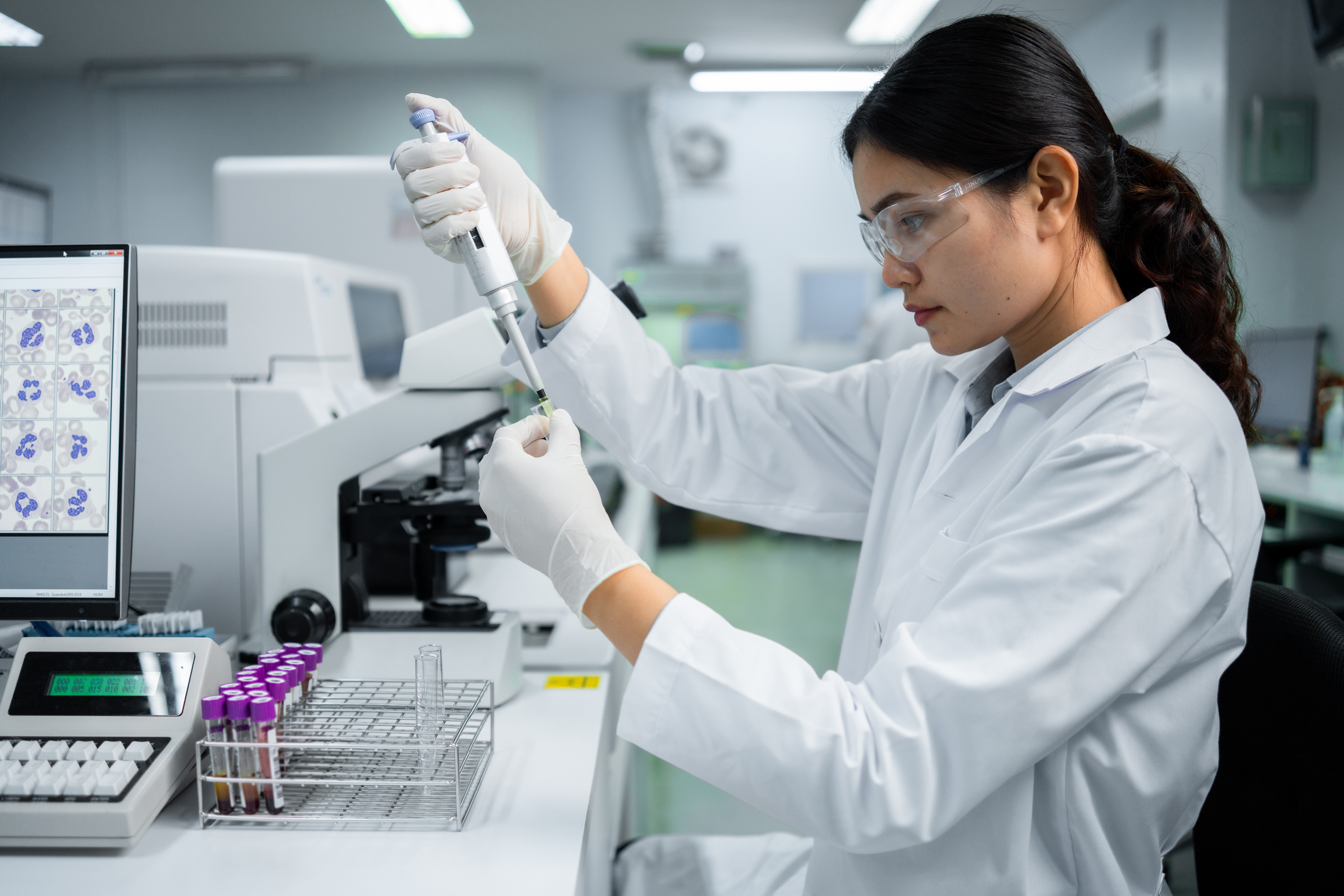 A BRCA gene mutation ups your risk of these 4 cancers. Here's what to know.