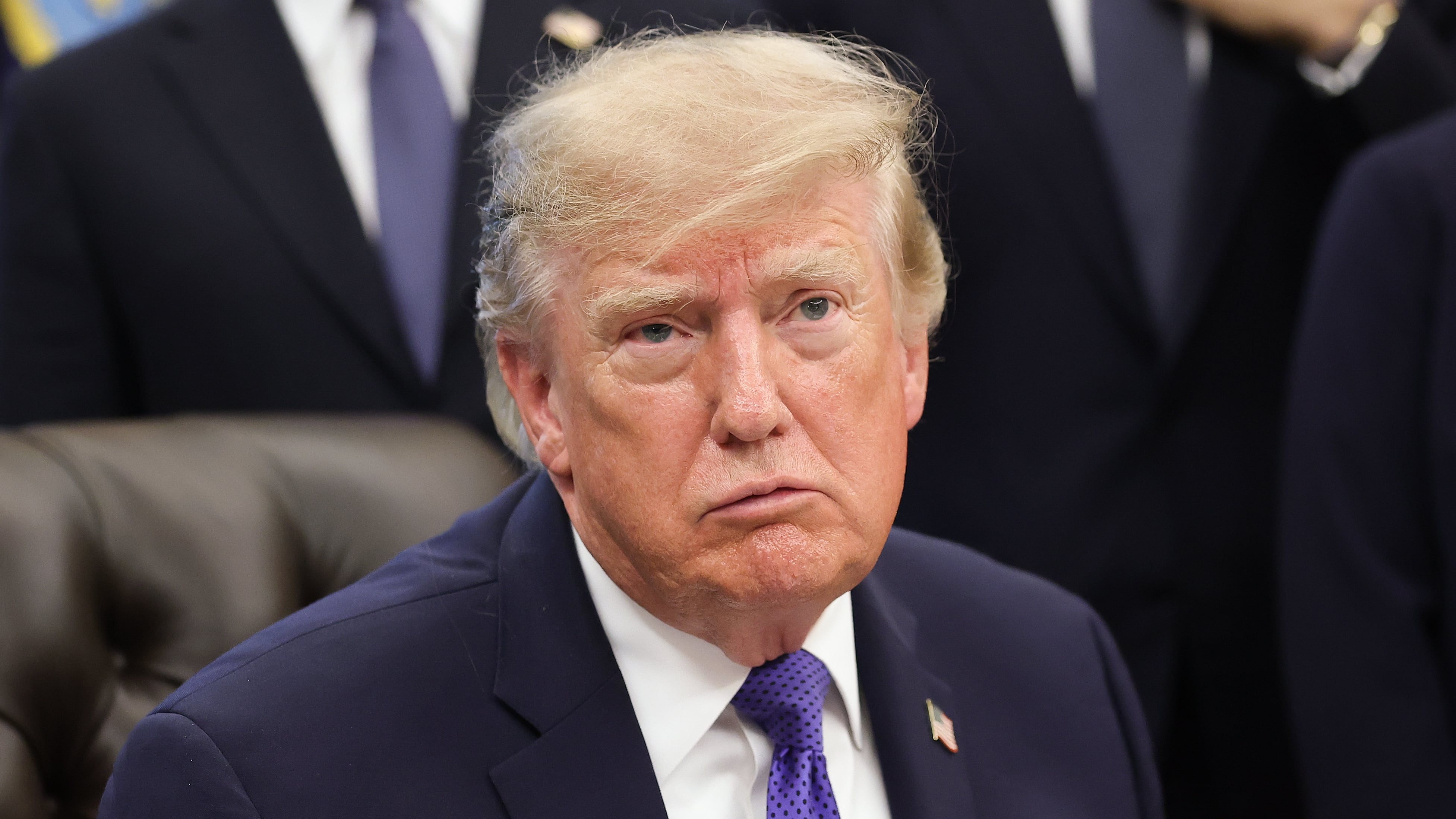 Trump’s desperate bruise cover-up gets ugly in new shock photo