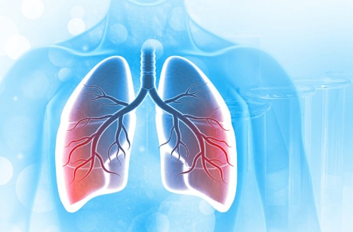 Lupin introduces world’s first fixed-dose triple combination drug for ...