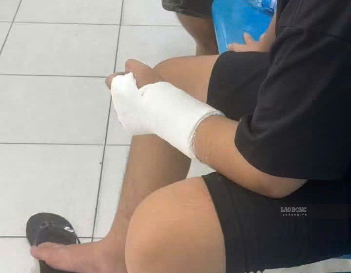 Nam sinh lớp 11 ở Khánh Hòa bị nhóm người đánh, nứt xương tay