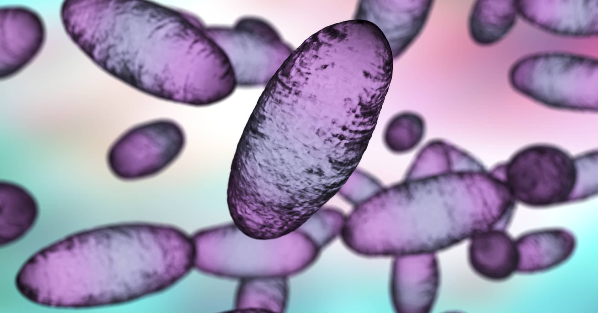 Russia plague: How great is the global risk? Maybe low, but infectious ...