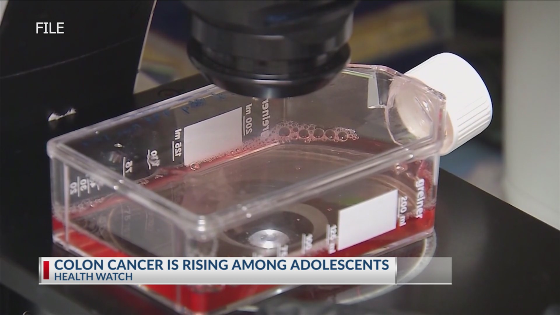 Colon cancer is rising among adolescents