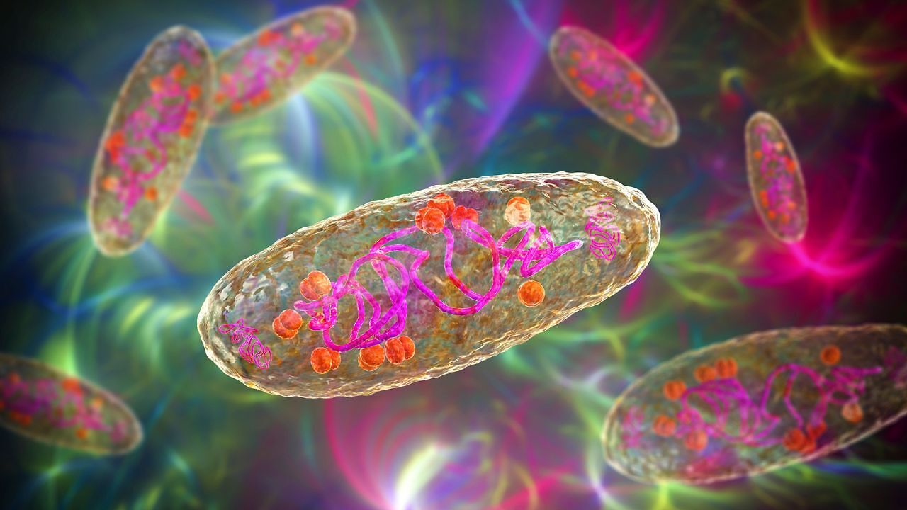 WHO seeks clarity after Russian lab technician dies of severe pneumonia ...