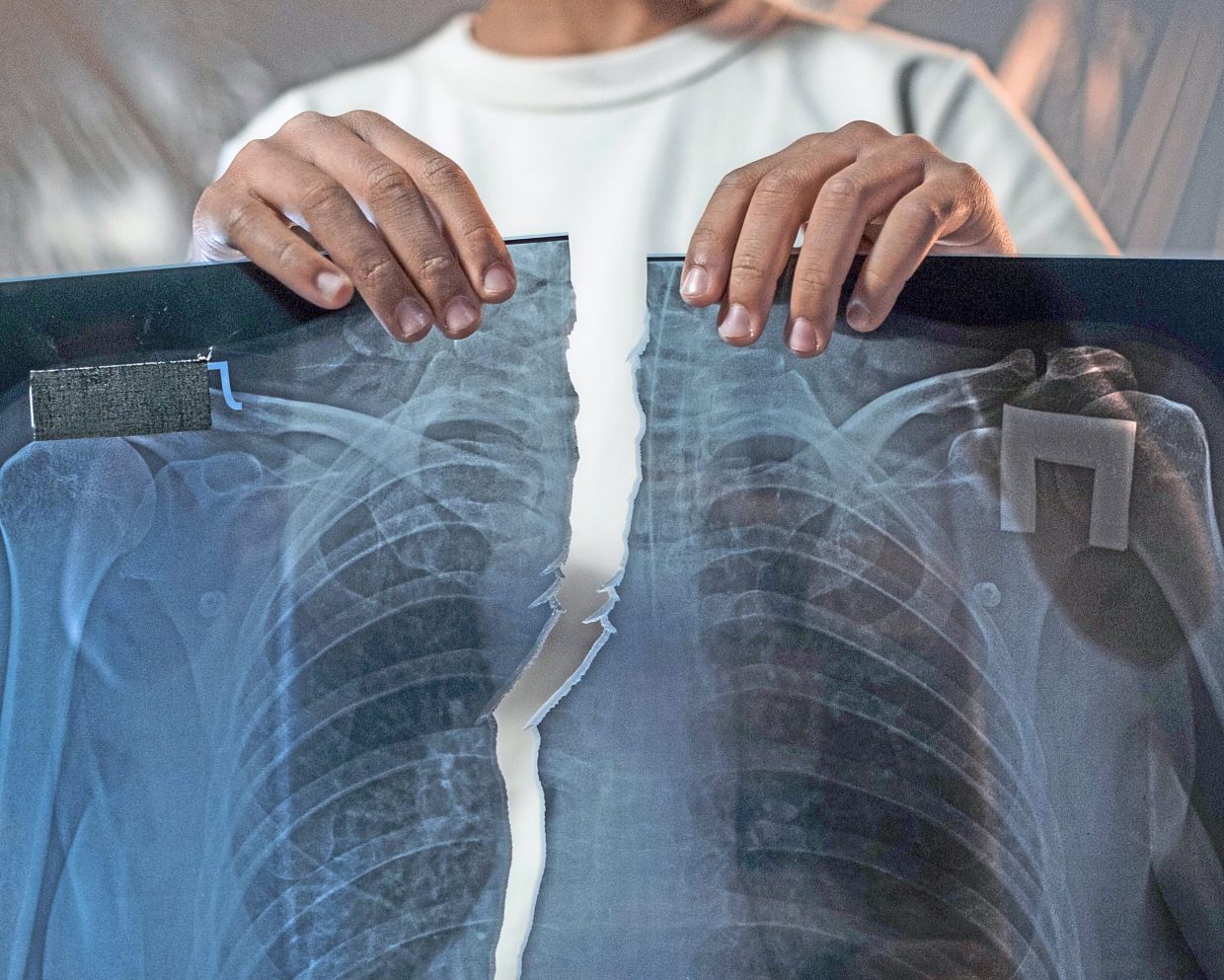 One in four at risk of lung disease