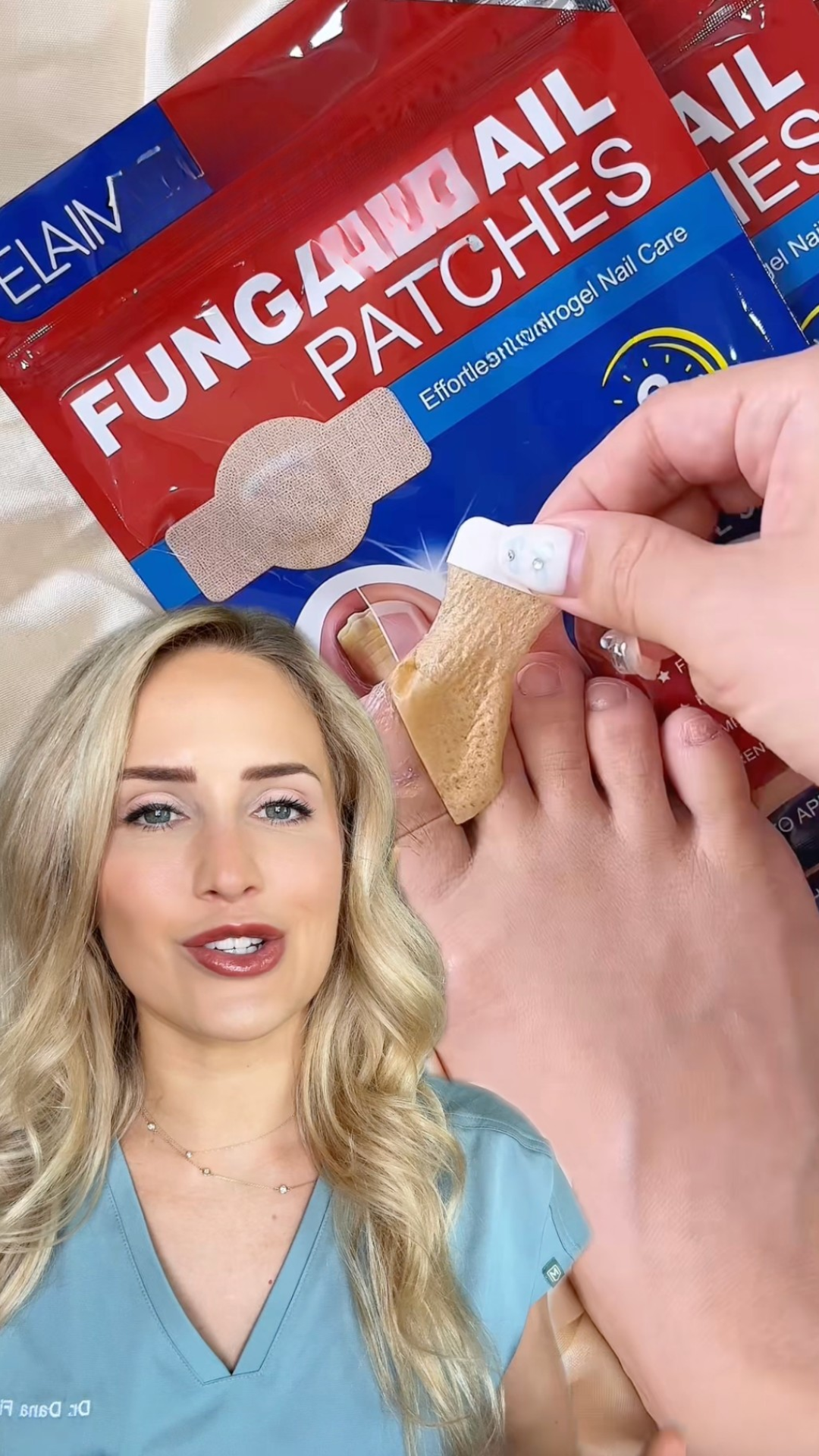 Do anti-fungal patches actually work?