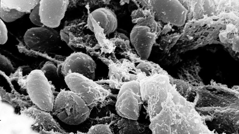 WHO seeks answers after Russian lab worker dies; second pneumonia ...