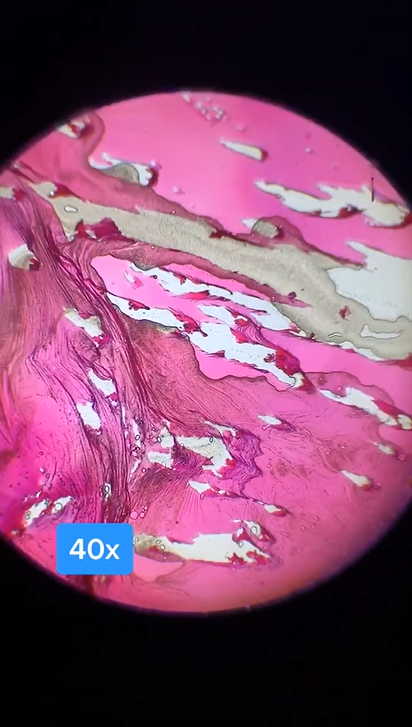 Interesting objects seen under a microscope