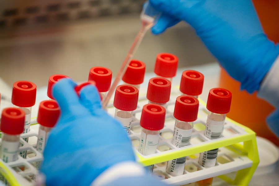 Plague in Russia sparks concern, COVID-19 pandemic memories: 5 things ...