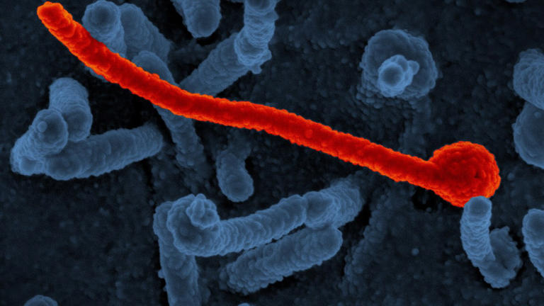 The Bundibugyo Ebola outbreak has reached 8,463 confirmed cases and ...