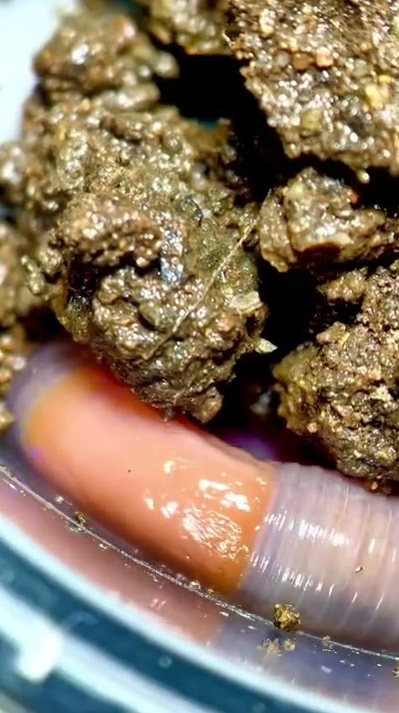 Earthworm under the microscope