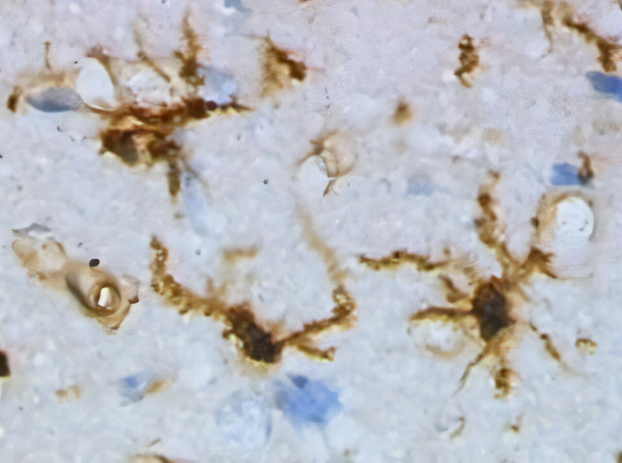 Brain immune cells protect neurons in Parkinson's disease by nibbling ...
