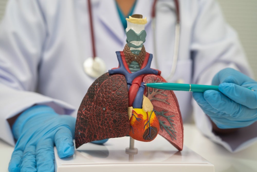 ArriVent’s stock plummets on Phase III NSCLC trial failure