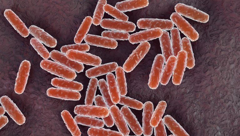 Is pneumonic plague in America? What to know as the infection spreads ...