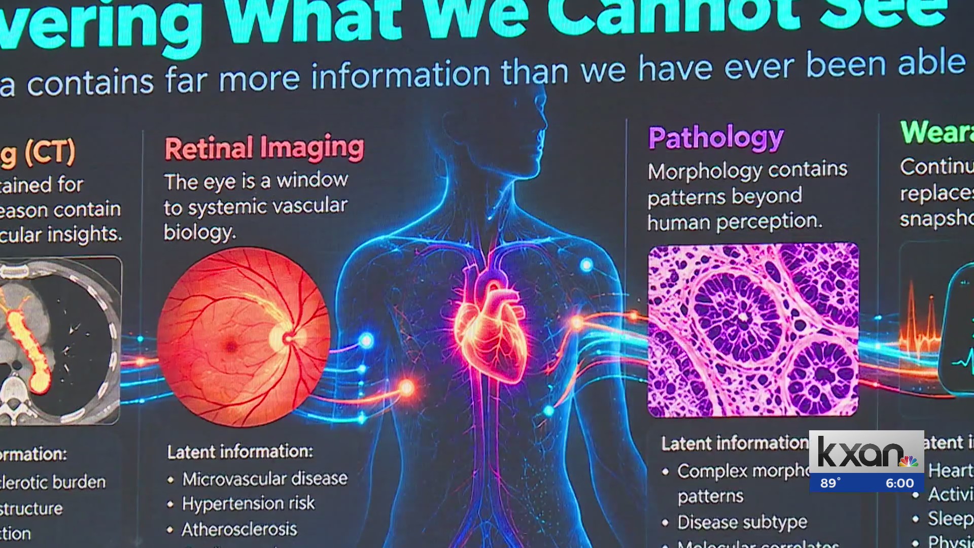 UT symposium explores AI’s growing role in future of health care