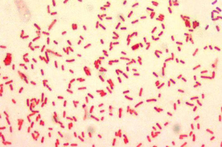 Experts explain how Russia's terrifying plague investigation could ...