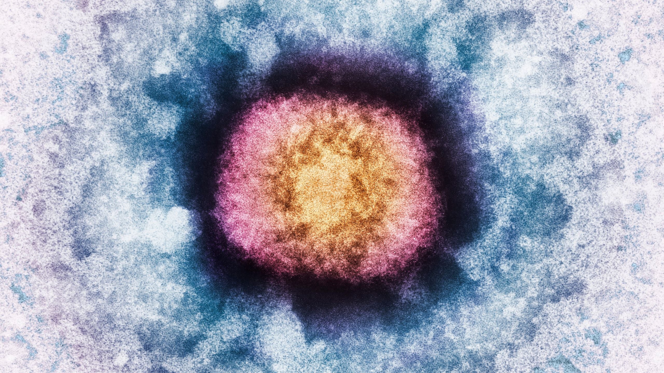 DNA from a human brain gene has turned up in a virus
