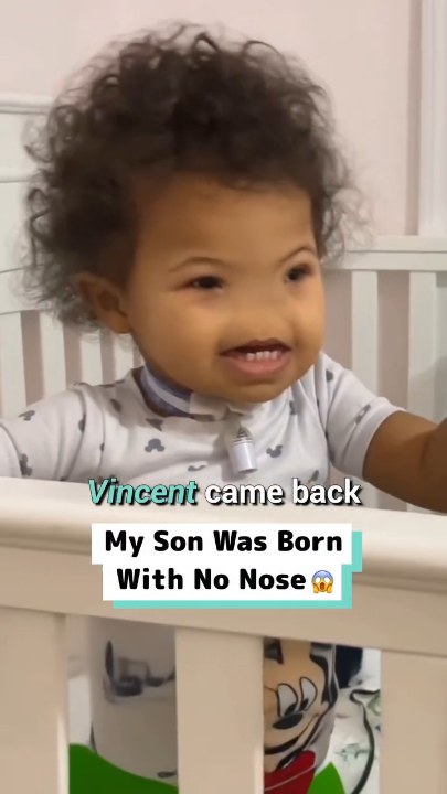 My son was born with no nose @maddie.taul