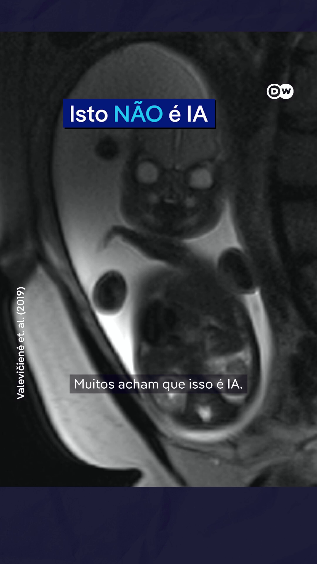 Ressonância magnética de fetos