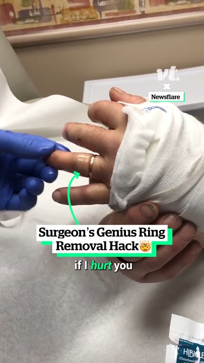 Surgeon's genius ring removal hack