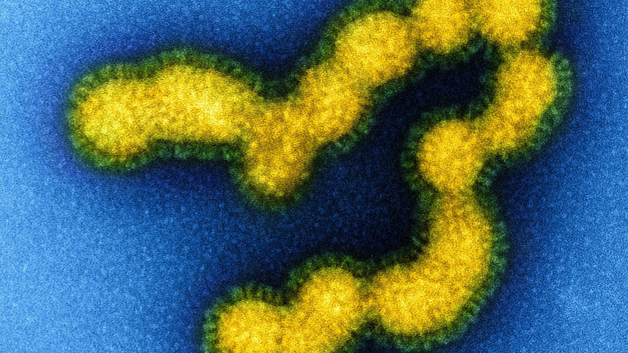 A mutated H1N1 flu strain turned up in 13 of 17 Seattle samples as ...