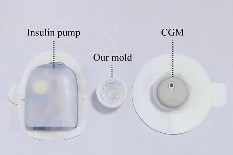 Chinese team says its all-in-one mini artificial pancreas offers next ...
