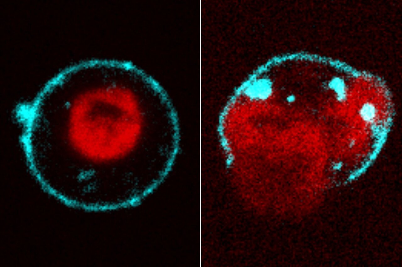 Changes in DNA packaging help immune cells swell and burst