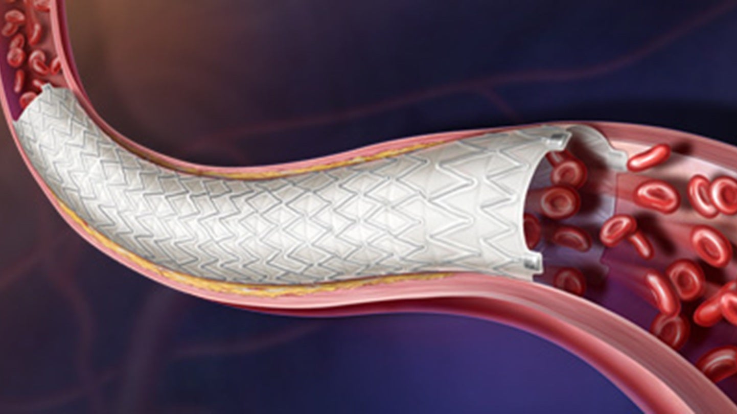 BD reports nine-month Agility trial data for Revello stent