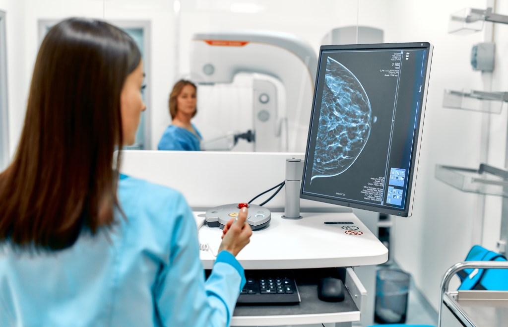 Mammograms can offer a hint about heart disease risk — so why isn’t it ...