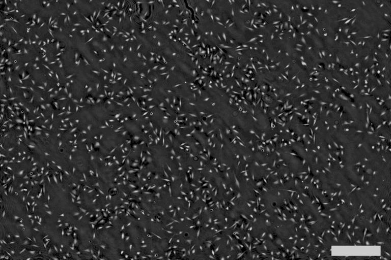 Lensless imaging method enables long-term monitoring of living cells ...