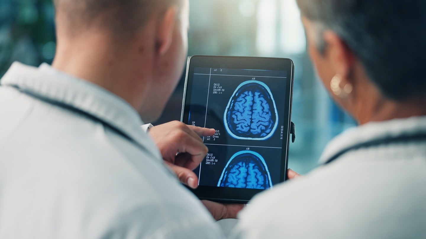 INBRAIN reports data from MINIGRAPH project for brain disorders