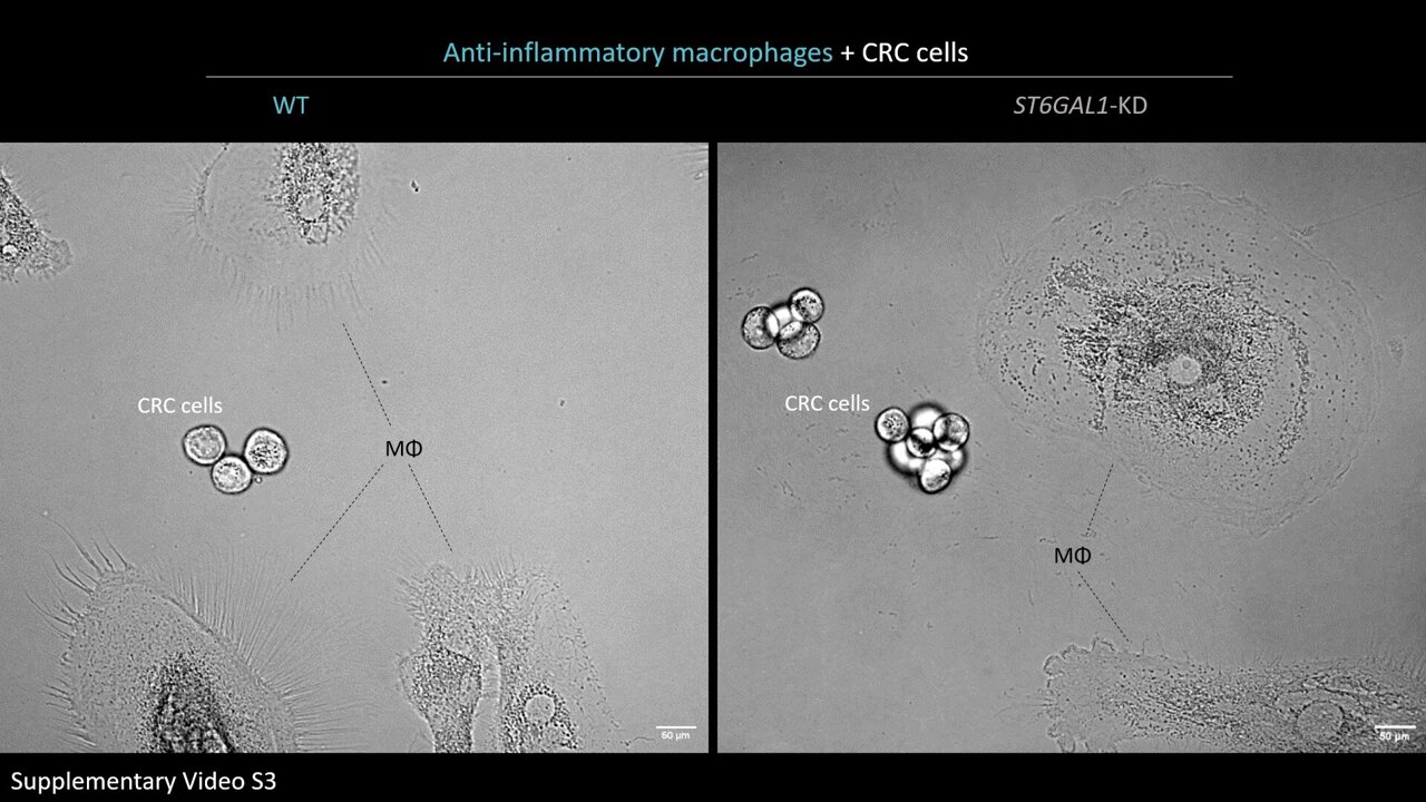 Shifting immune cells toward cancer-fighting mode: Sugar-coated ...