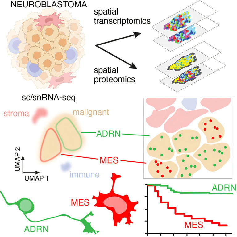 Scientists identify the neuroblastoma cells that signal poor outcomes