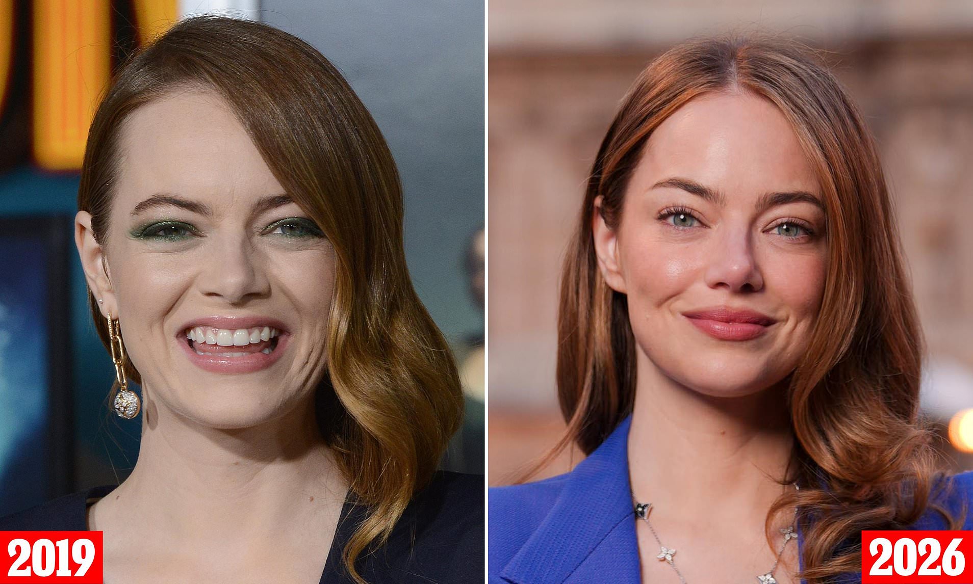Inside Emma Stone's rumored plastic surgery tweaks after sparking ...