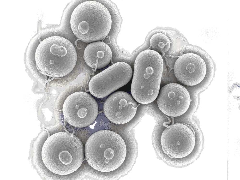 Drug-resistant sexually transmissible bacterial infection rising in US ...