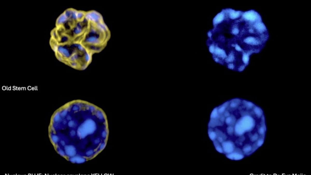Barcelona team develops AI that detects ageing in blood stem cells