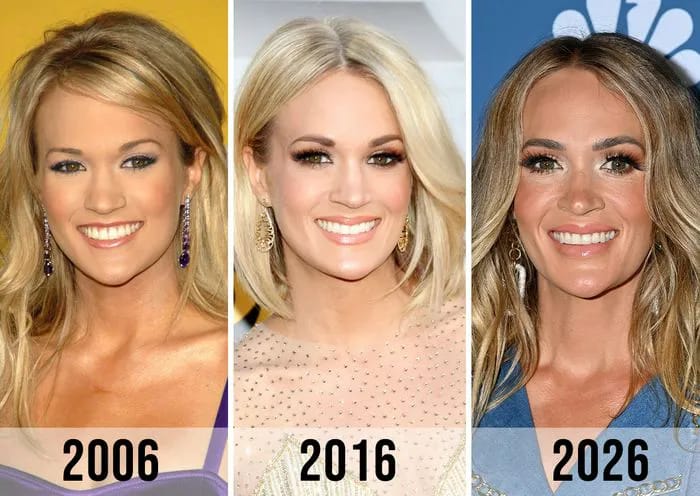Fans React To Carrie Underwood's 'Filler & Botox' In New Video As They ...