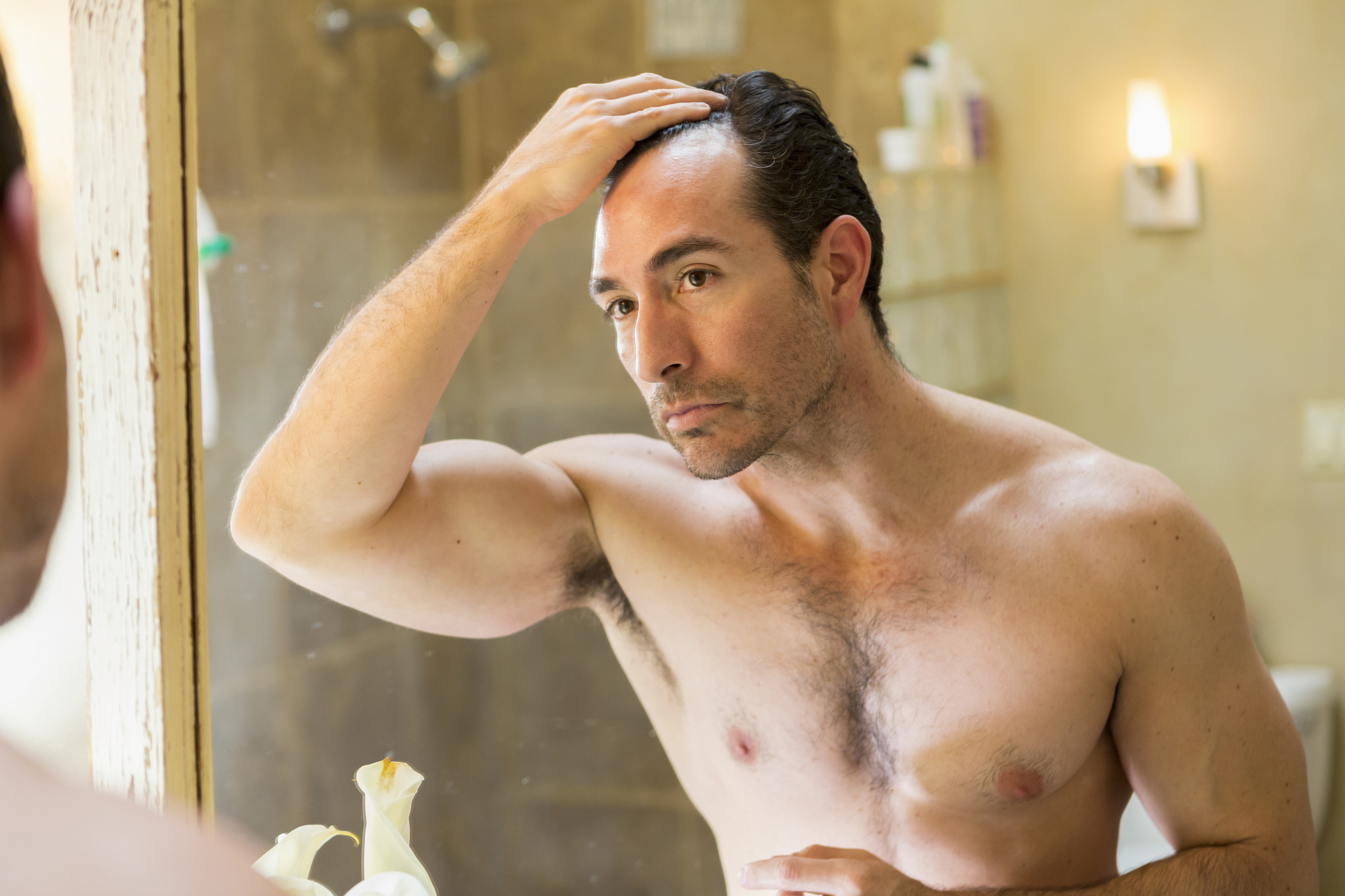 Male pattern baldness: what works, what doesn’t and when to act