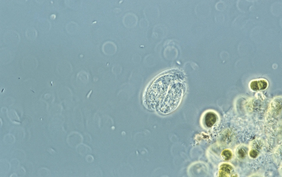 Oxford pond microbe defies genetic code rules