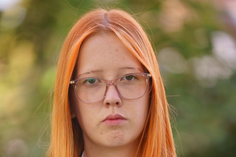 School accused of singling Kara, 15, out for being ginger