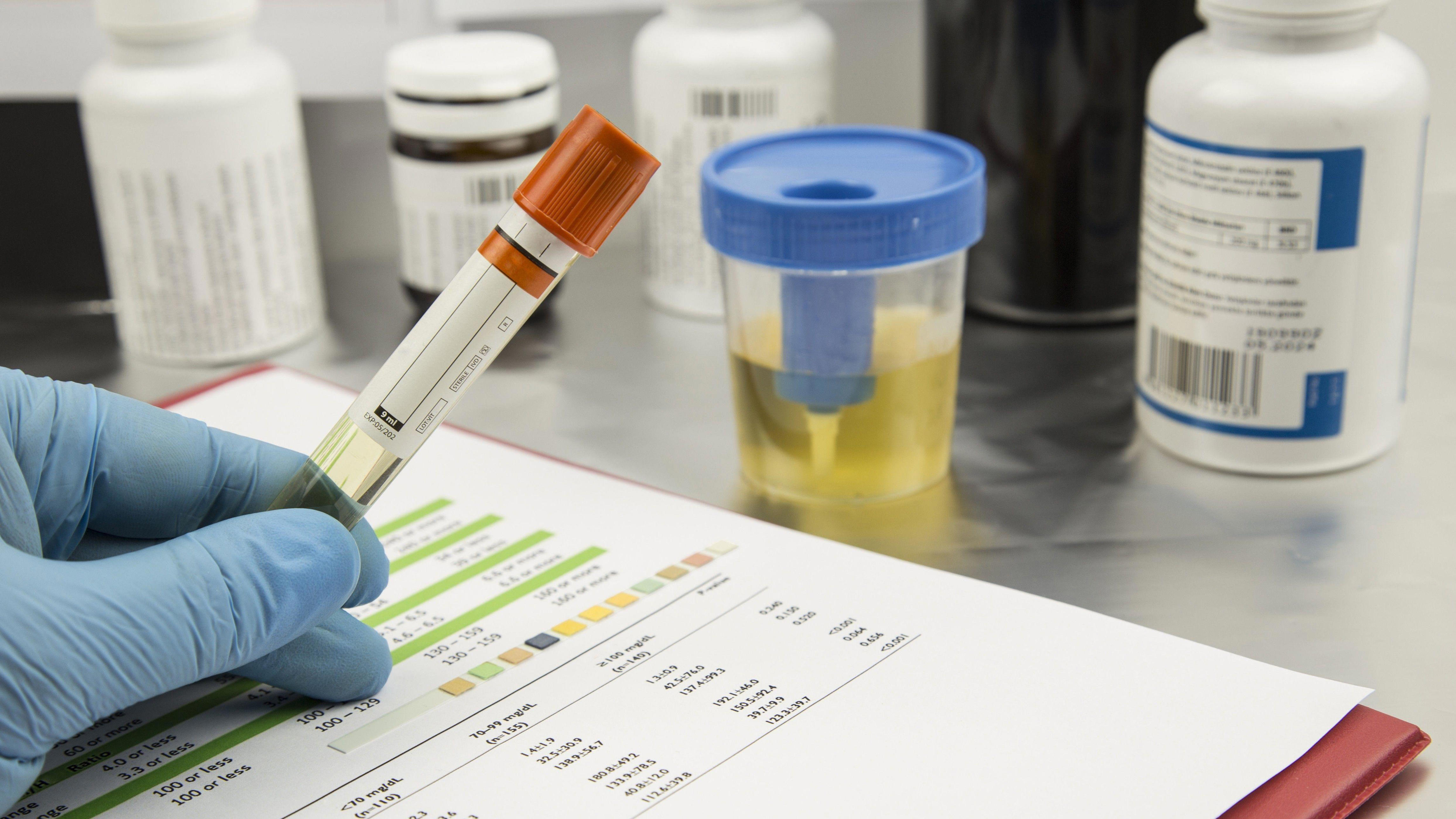Urine sample found in vaccine fridge at GP surgery, 'damning' report finds